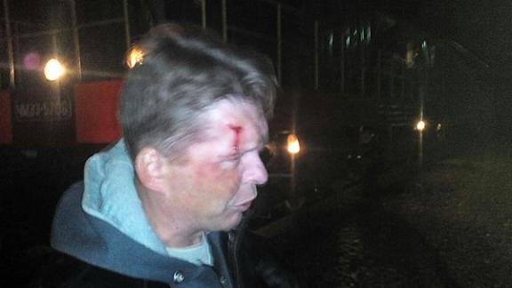 В Ставрополе мужчина попал под поезд и выжил