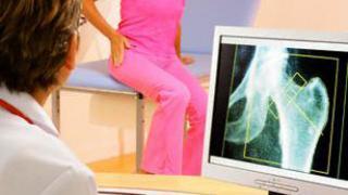 Программа по раннему выявлению остеопороза стартовала в Ставрополе